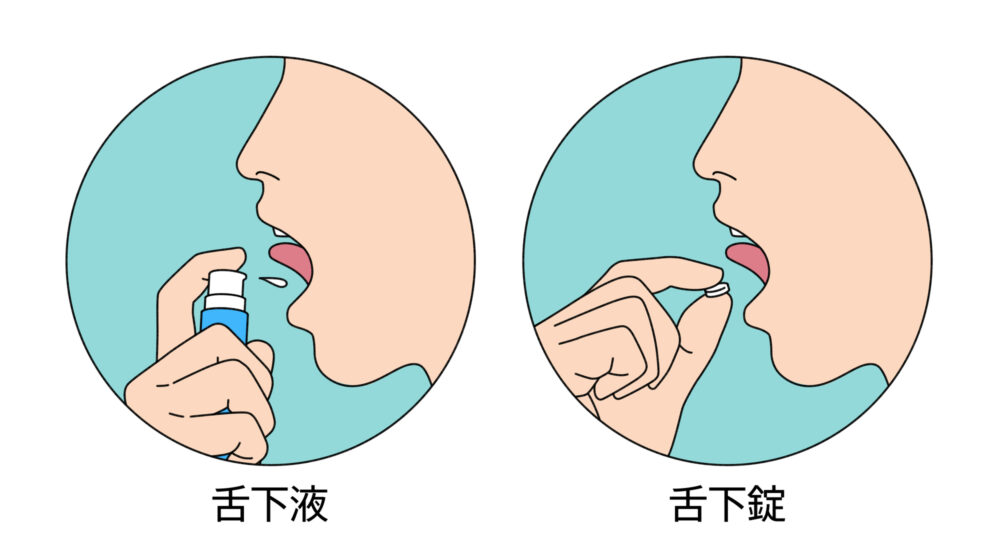 舌下免疫療法
