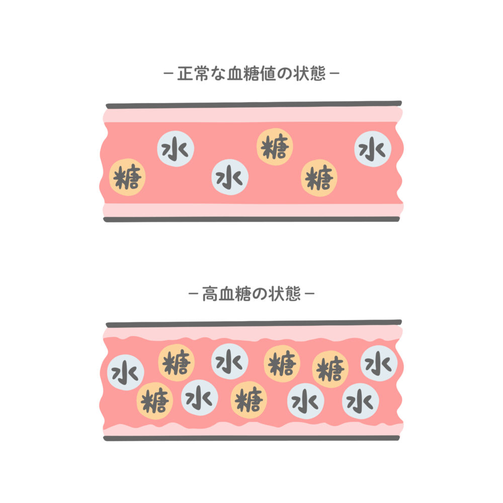 糖尿病の合併症